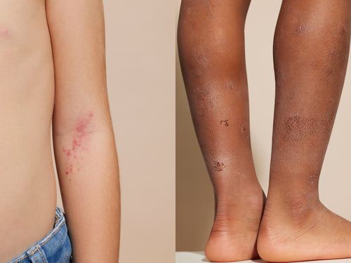 Duo Essentiel Anti-Grattage - Mustela Canada - 3